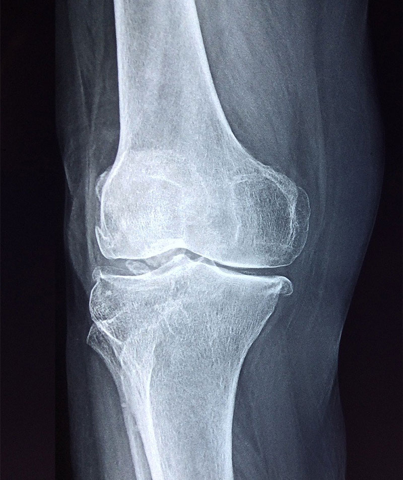 synflex-joint-glucosamine Synflex Glucosamine Joint